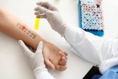 Young woman undergoing procedure of allergen skin tests in clinic 